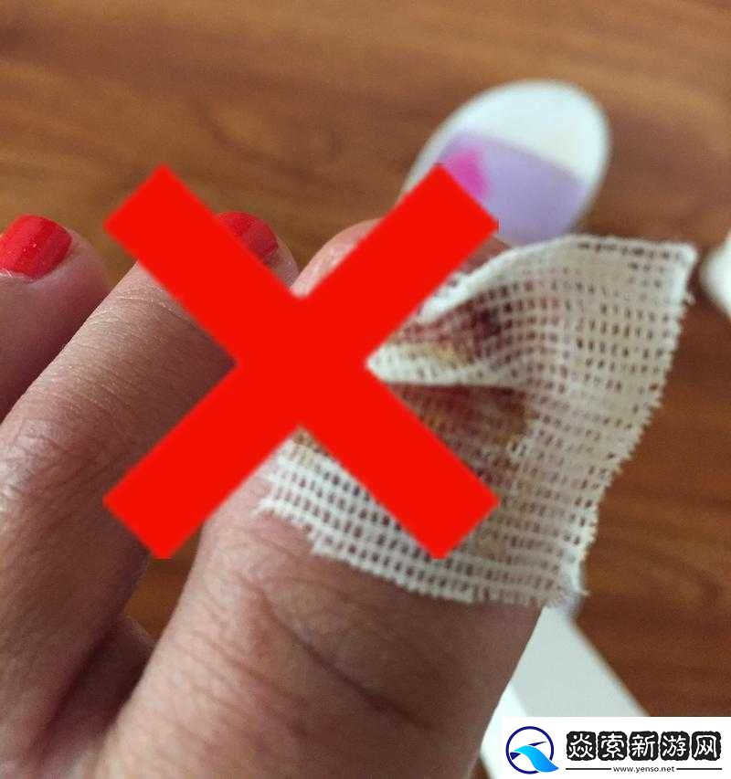 红肿疼痛小缝不能合拢