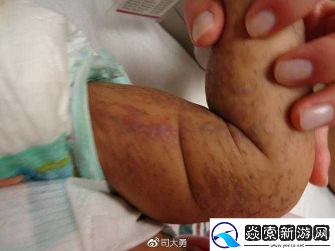 国色天香综合征