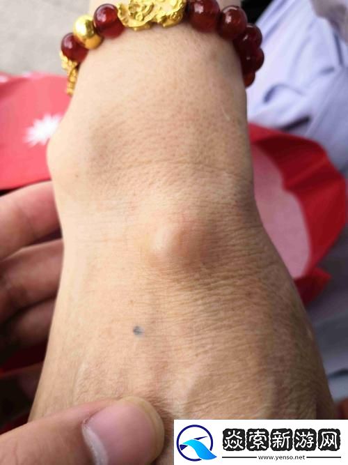 “硬疙疙”图片狂潮