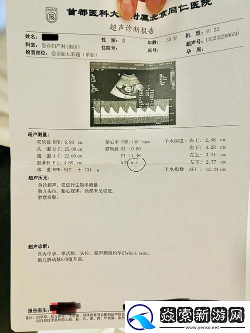“OVO食肉族报告4”