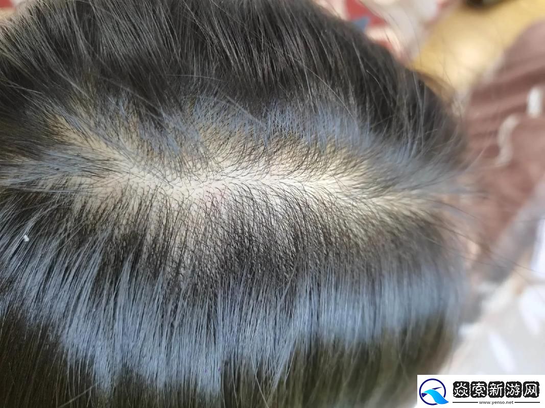 “头发生长记”