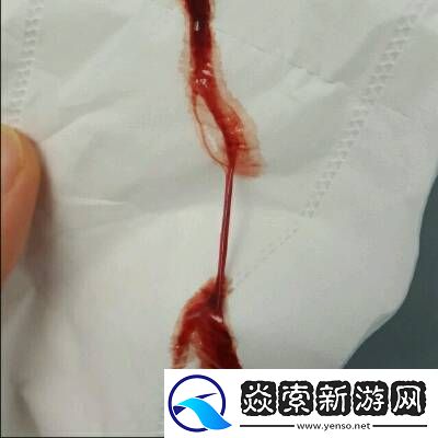 女生自己安慰后出血