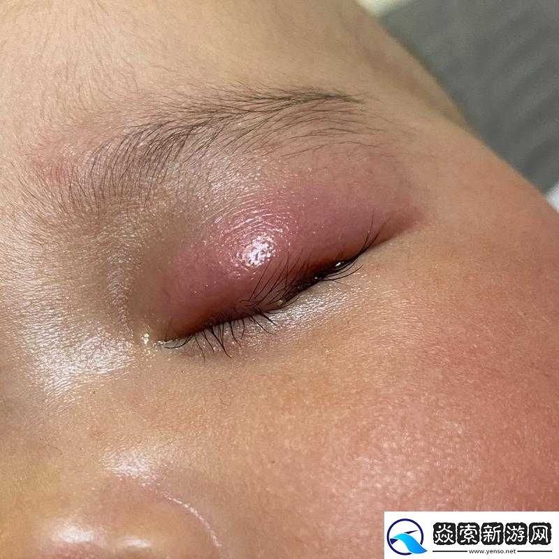 宝宝下面湿透且嘴硬喊疼令人揪心的特殊状况