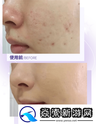 精油一线二线三线区别在哪