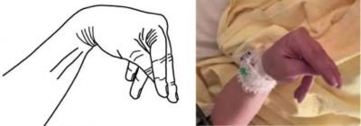 探究女性在巅峰时期抽搐的原因